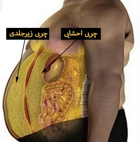 چربی زیرجلدی چیست؟
