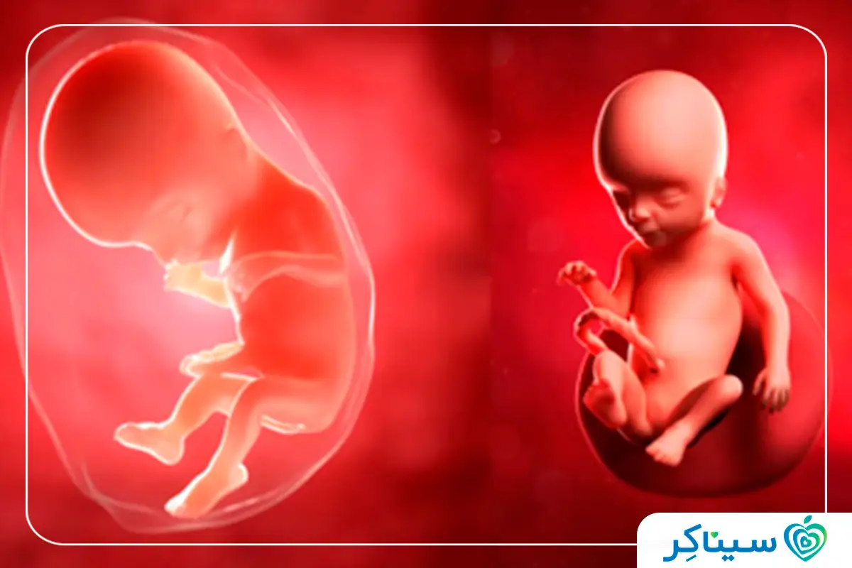 عکس جنین در هفته هفدهم