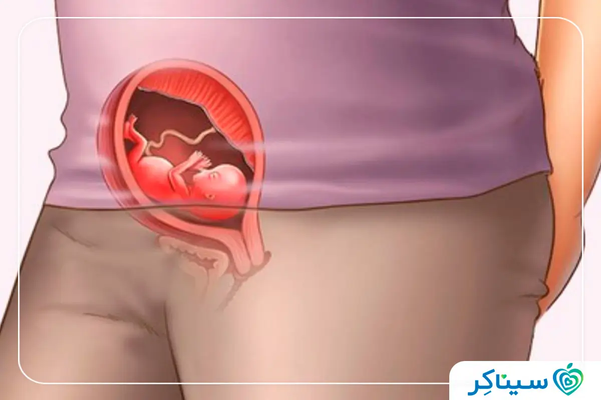 وضعیت جنین در رحم مادر در هفته چهاردهم بارداری