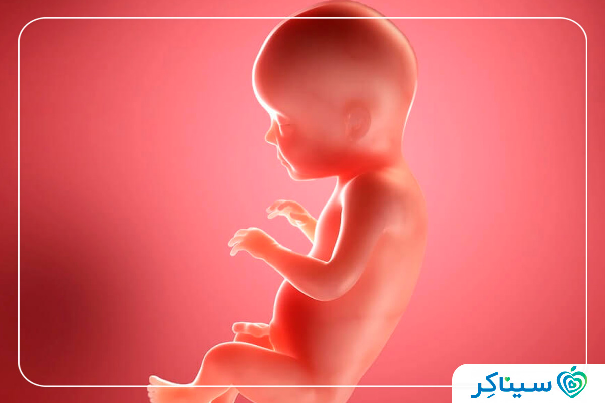 عکس نوزاد 28 هفته