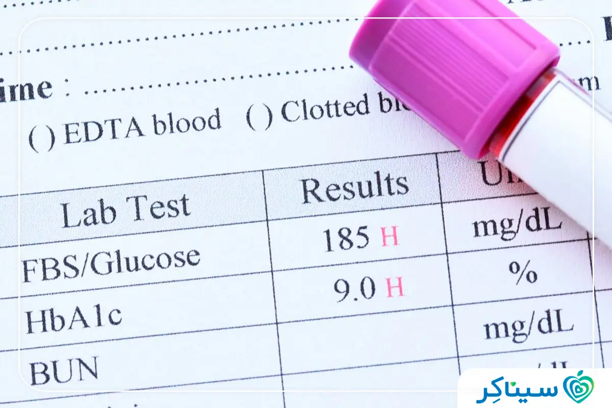 آزمایش قند خون ناشتا