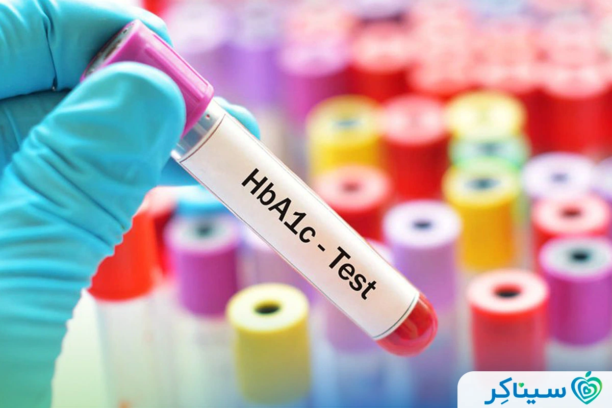 سطح هدف تست HbA1c