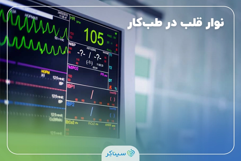 نوار قلب در معاینات طب کار