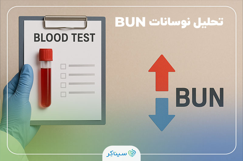 دست یک متخصص آزمایشگاه که یک برگه آزمایش خون با عنوان BUN و دو فلش قرمز و آبی را نگه داشته است؛ تصویر در زمینه‌ای روشن و ساده.