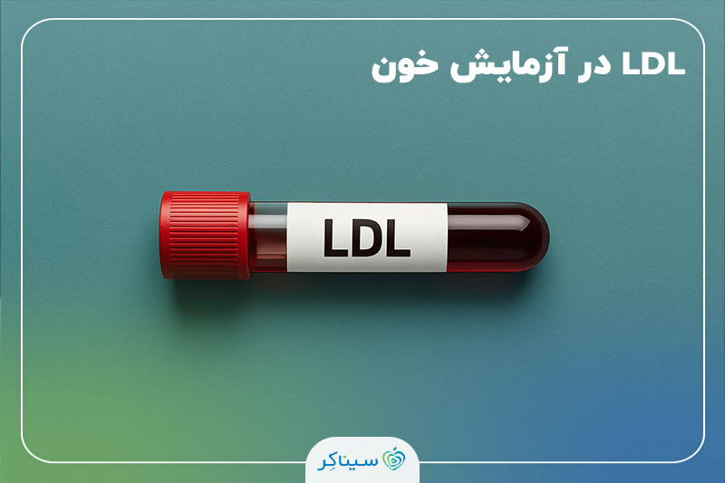لوله آزمایش خون با برچسب LDL روی زمینه‌ی سبزآبی، نماد بررسی سطح کلسترول بد در بدن