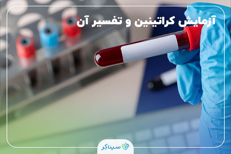 لوله آزمایش خون در دست پزشک برای سنجش سطح کراتینین و ارزیابی سلامت کلیه‌ها