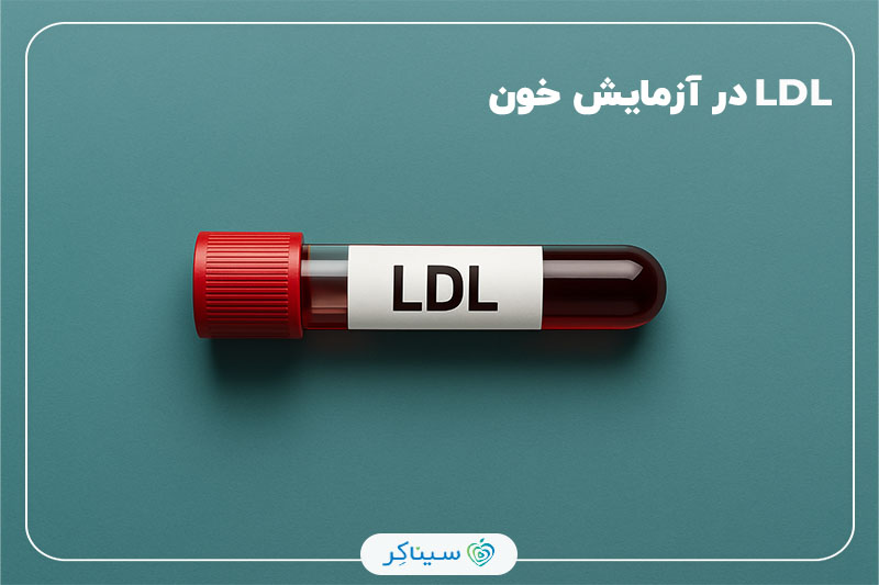 لوله آزمایش خون با برچسب LDL روی زمینه‌ی سبزآبی، نماد بررسی سطح کلسترول بد در بدن