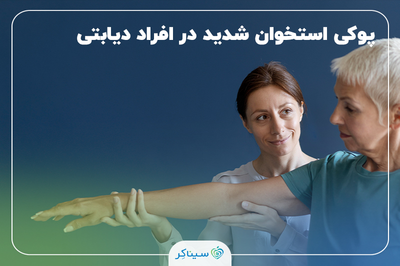 فیزیوتراپیست در حال بررسی دامنه حرکتی دست یک زن مسن برای ارزیابی و توانبخشی پوکی استخوان.