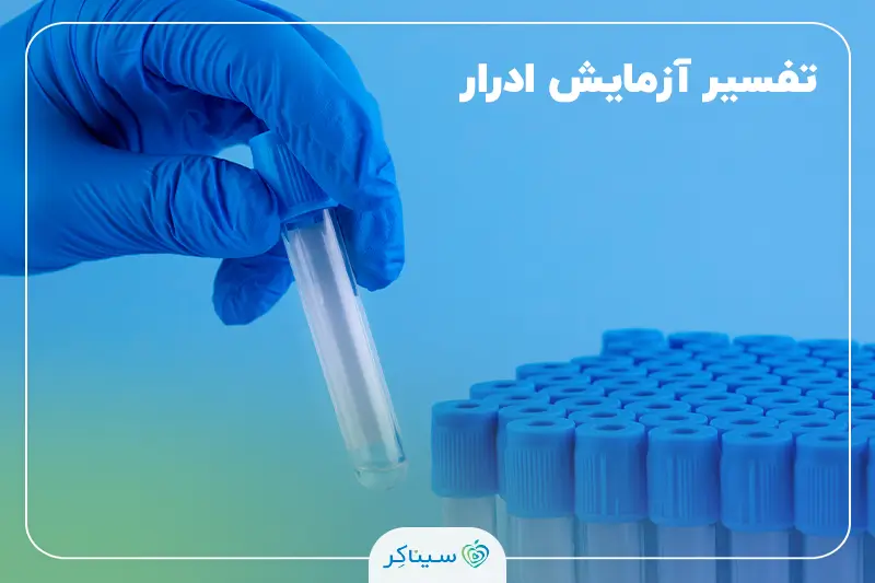 نمونه آزمایش ادرار در آزمایشگاه برای تفسیر و تشخیص پزشکی