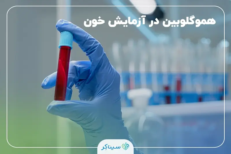 تفسیر و نقش هموگلوبین در ازمایش خون