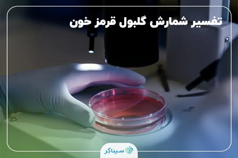 تفسیر RBC در آزمایش خون و ادرار و تحلیل گلبول‌های قرمز خون