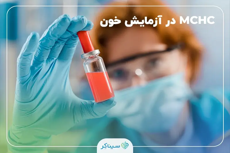 نمونه خون در آزمایشگاه برای اندازه گیری MCHC