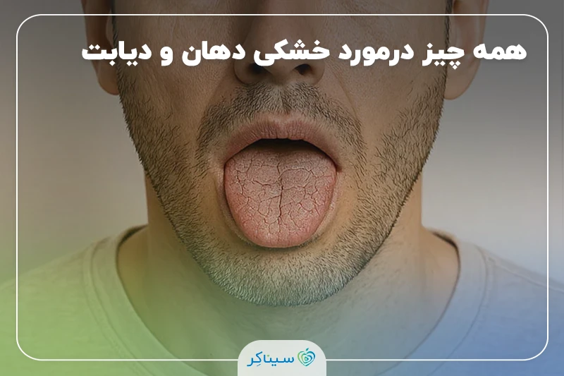 خشکی دهان و دیابت؛ علائم، علل و روش درمان آن